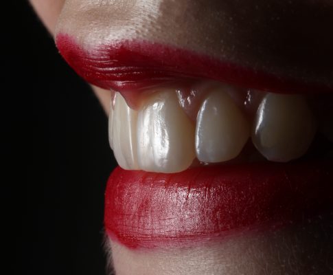 Implantes Dentales: Restaurando Sonrisas y Funciones