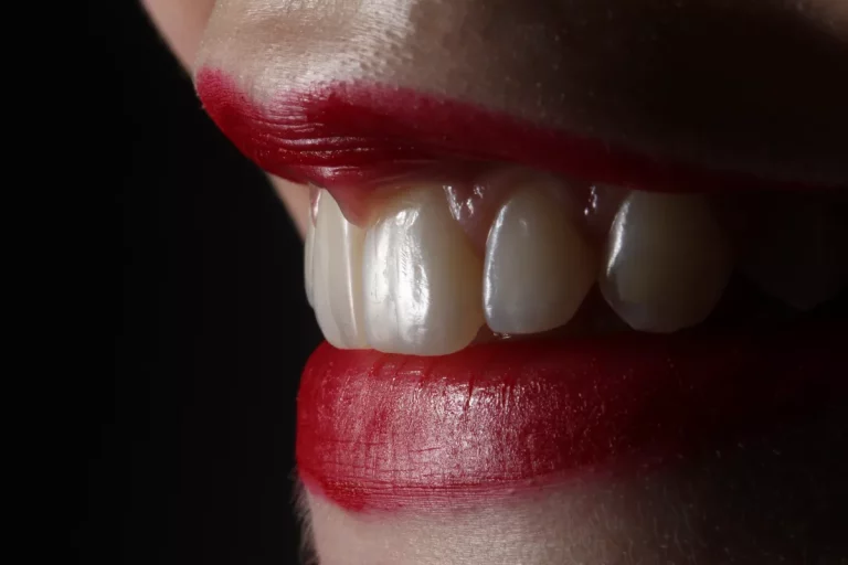 Implantes Dentales: Restaurando Sonrisas y Funciones